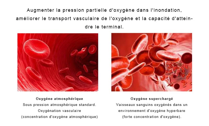 Qu'est-ce que l'oxygénothérapie hyperbare?